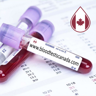 progesterone Private blood test in canada