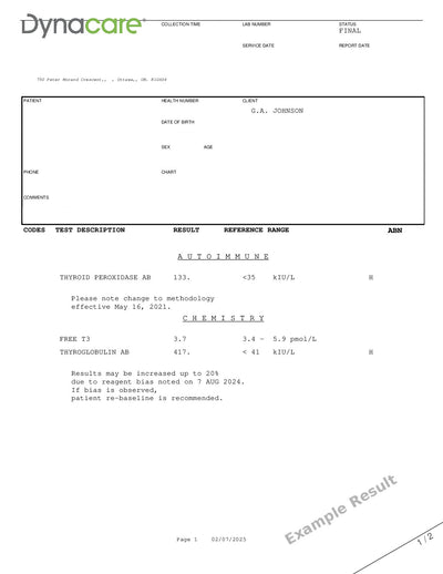 Thyroglobulin Antibodies